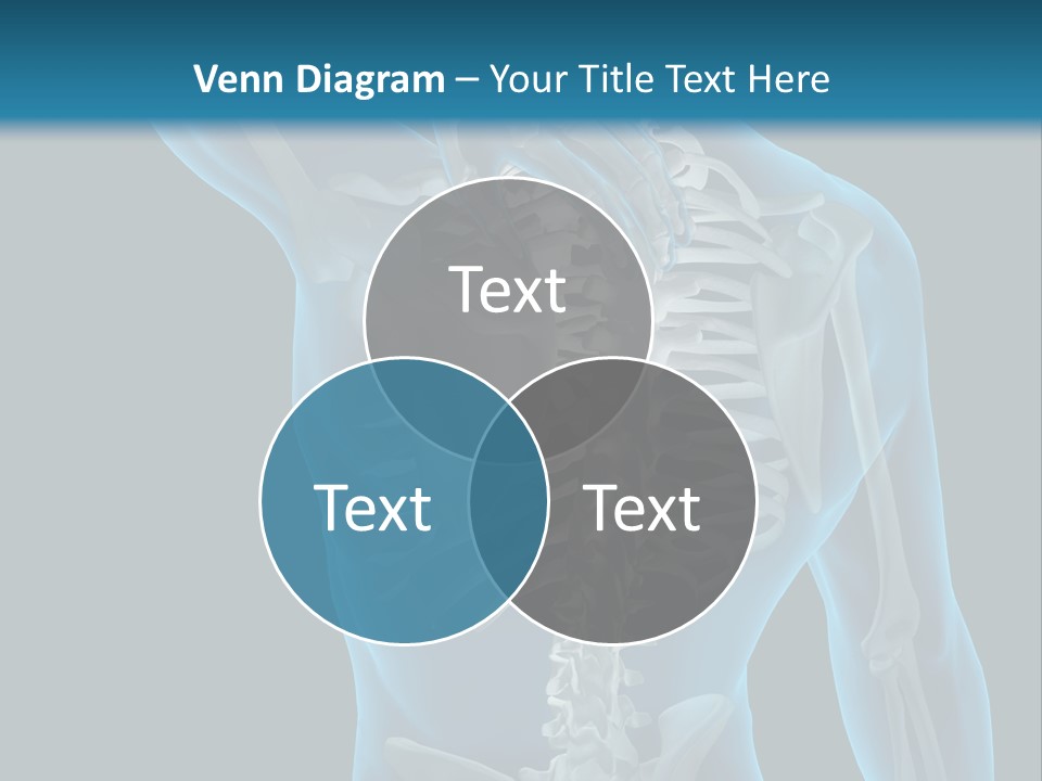 People Graphic Osteoporosis PowerPoint Template