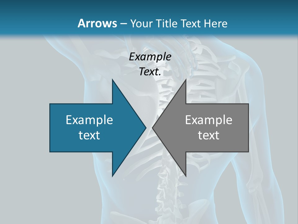 People Graphic Osteoporosis PowerPoint Template