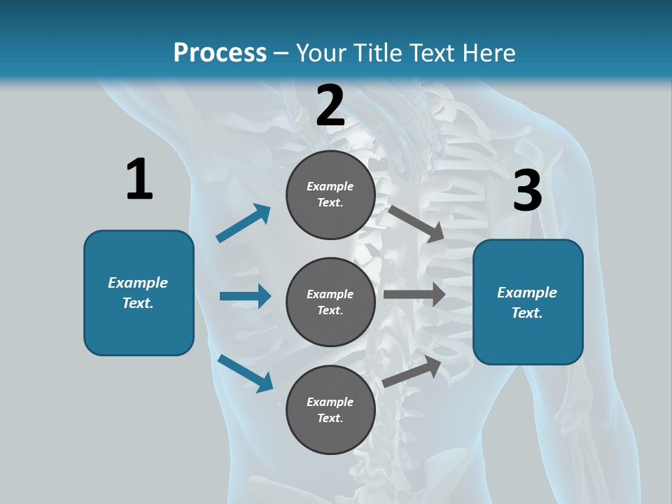 People Graphic Osteoporosis PowerPoint Template