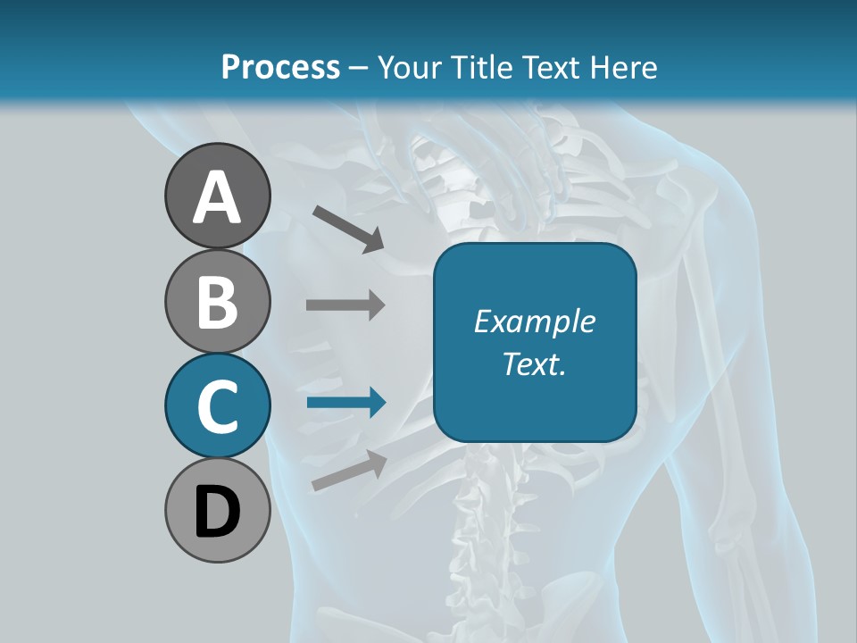 People Graphic Osteoporosis PowerPoint Template