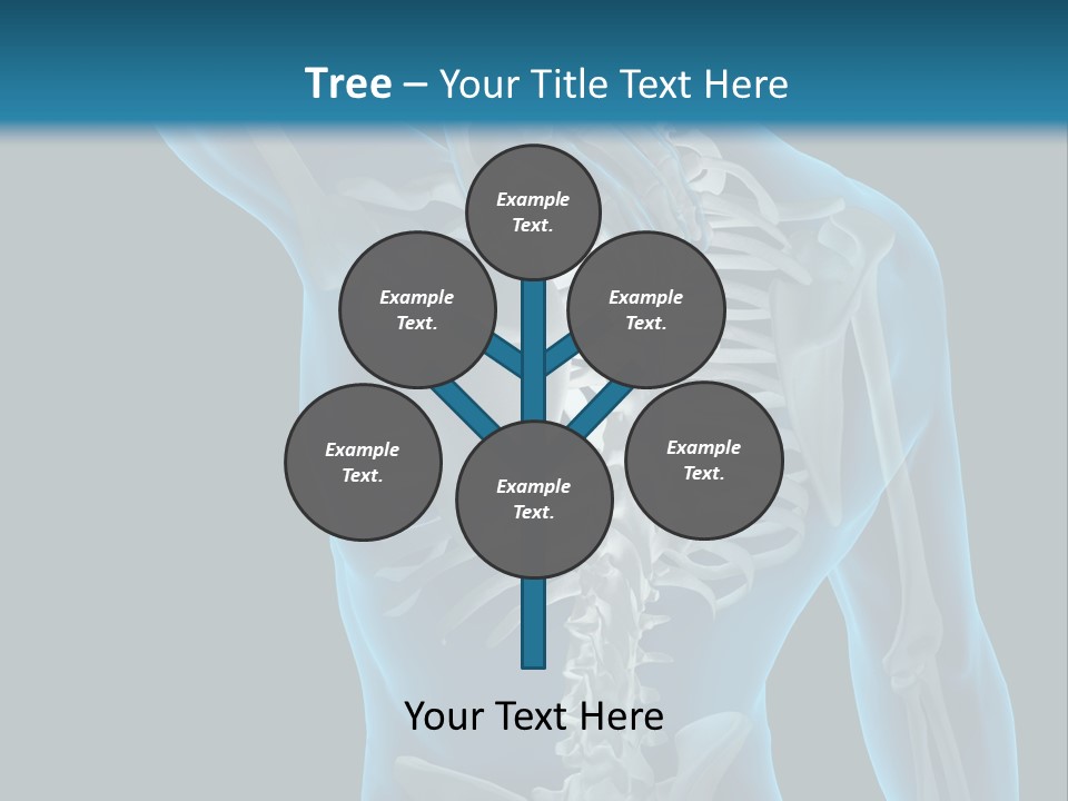 People Graphic Osteoporosis PowerPoint Template