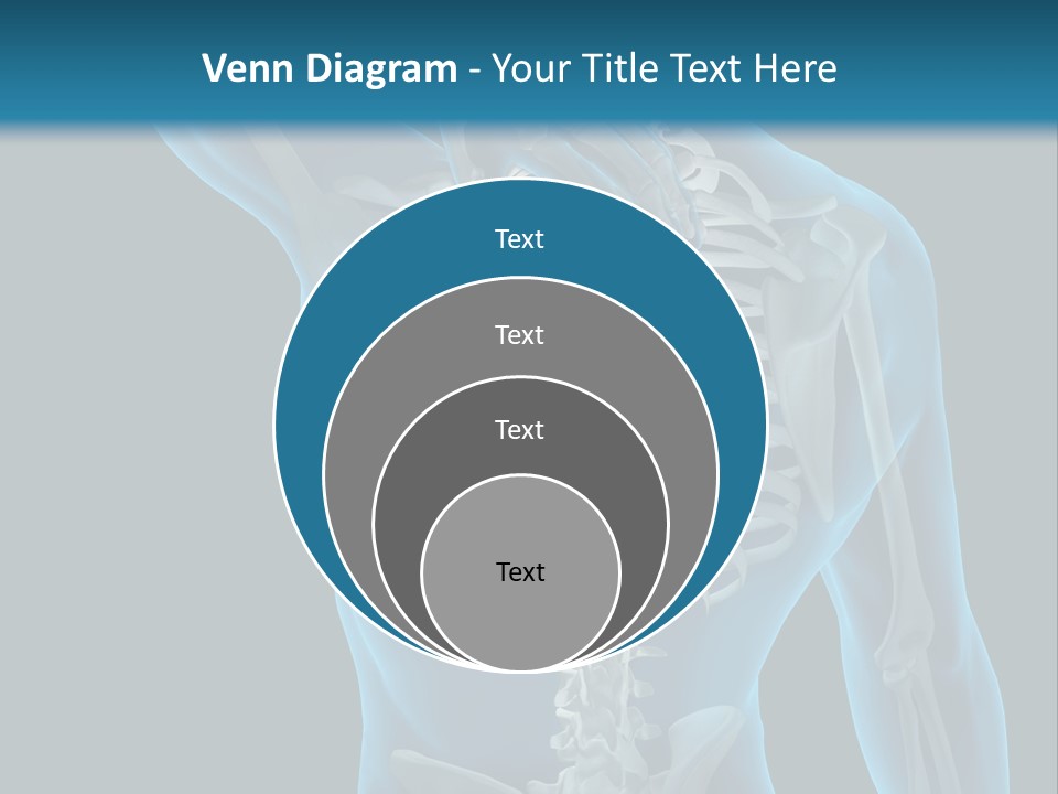 People Graphic Osteoporosis PowerPoint Template