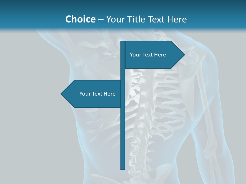 People Graphic Osteoporosis PowerPoint Template