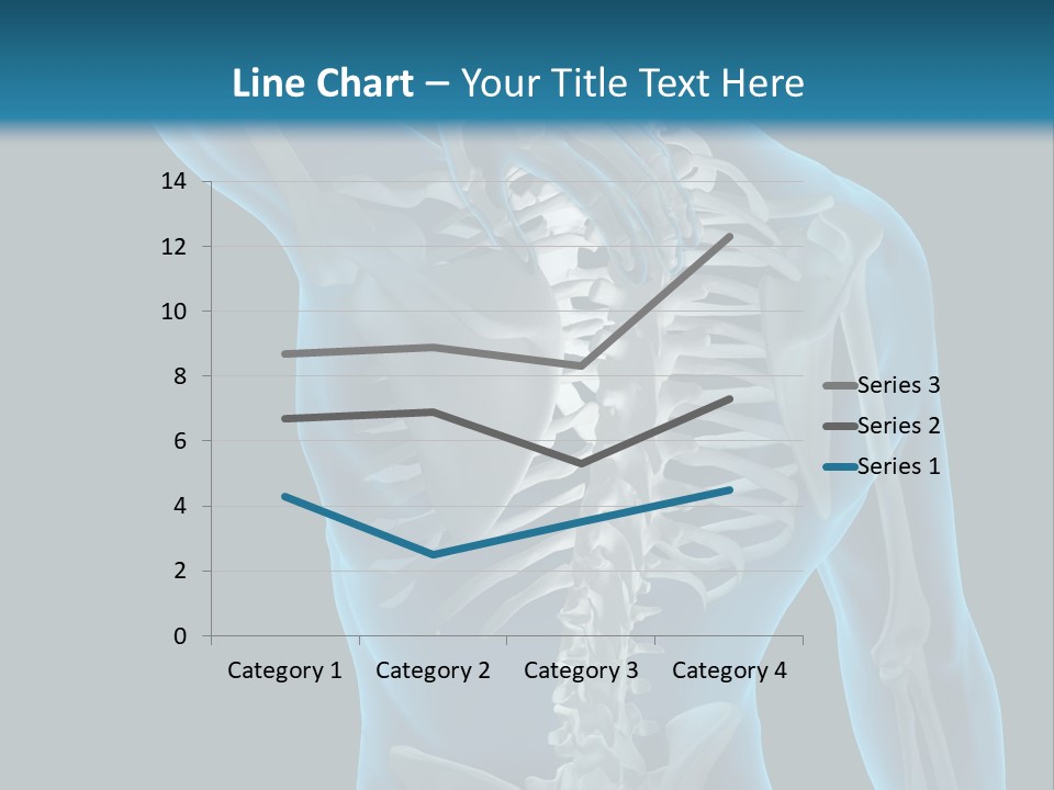 People Graphic Osteoporosis PowerPoint Template