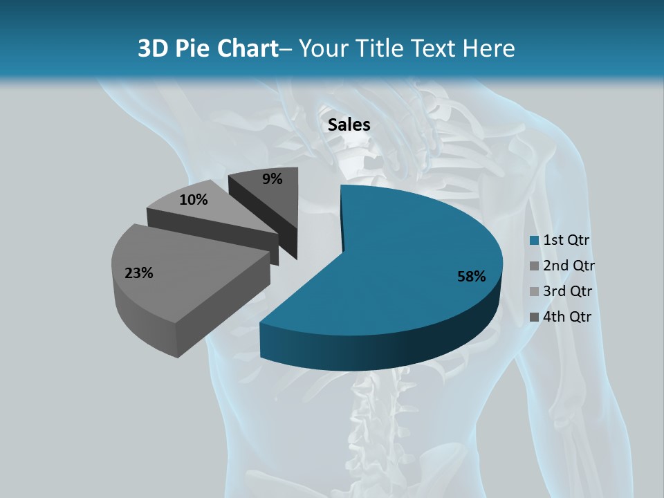 People Graphic Osteoporosis PowerPoint Template