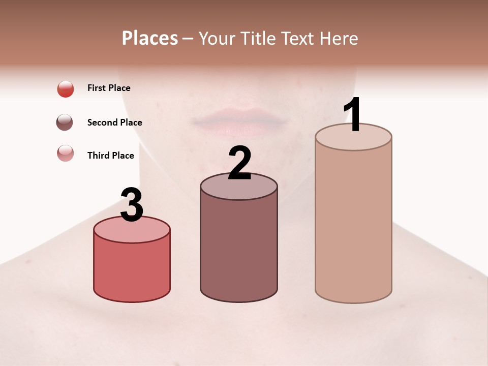 Irritation Young Youth PowerPoint Template