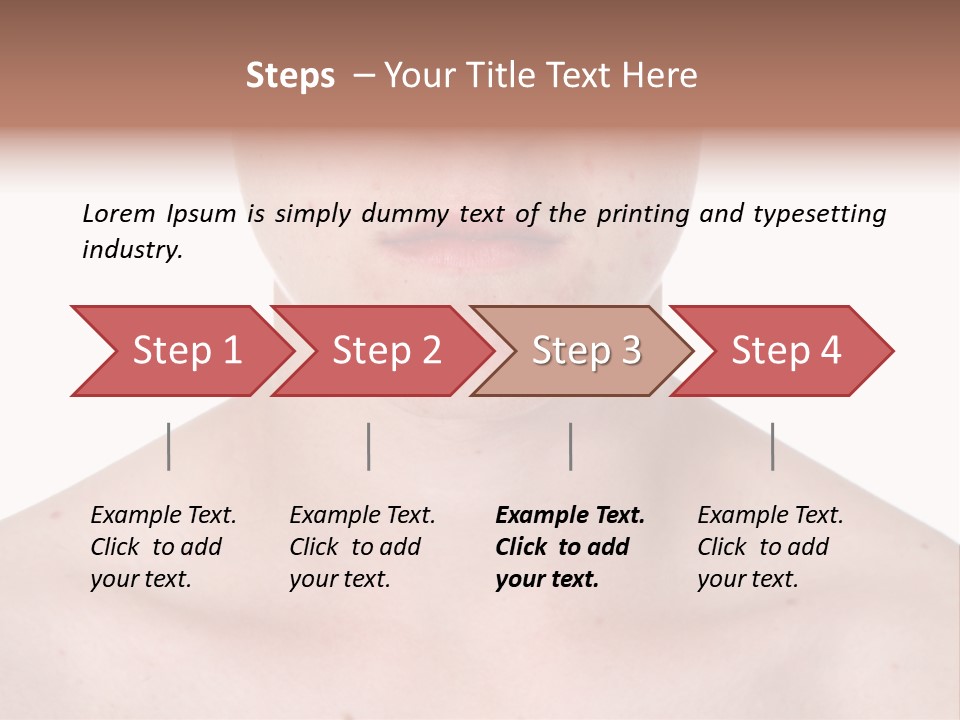 Irritation Young Youth PowerPoint Template