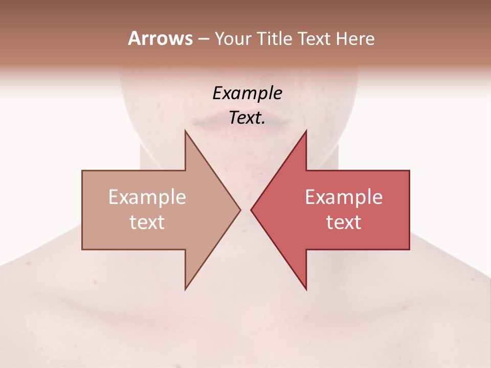 Irritation Young Youth PowerPoint Template