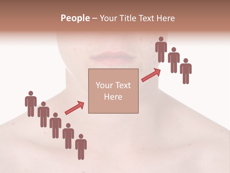 Irritation Young Youth PowerPoint Template