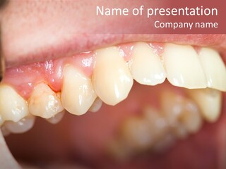 Mirror Exam Mouth PowerPoint Template