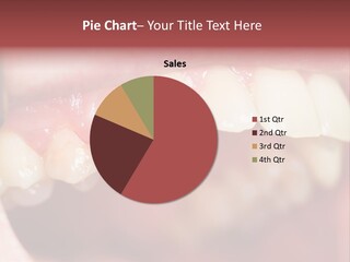 Mirror Exam Mouth PowerPoint Template