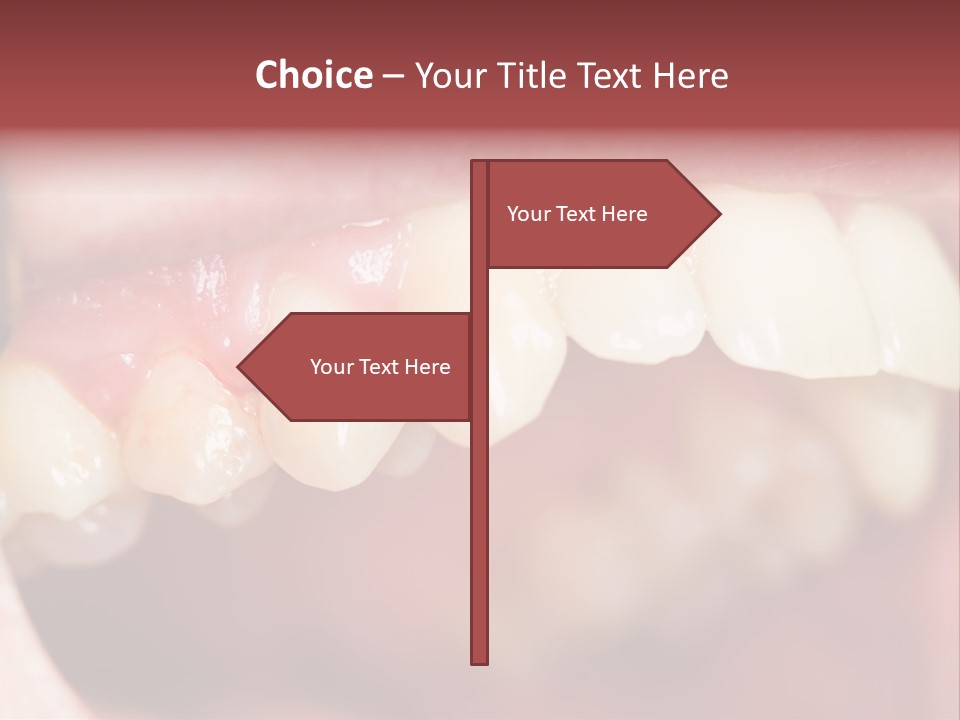 Mirror Exam Mouth PowerPoint Template