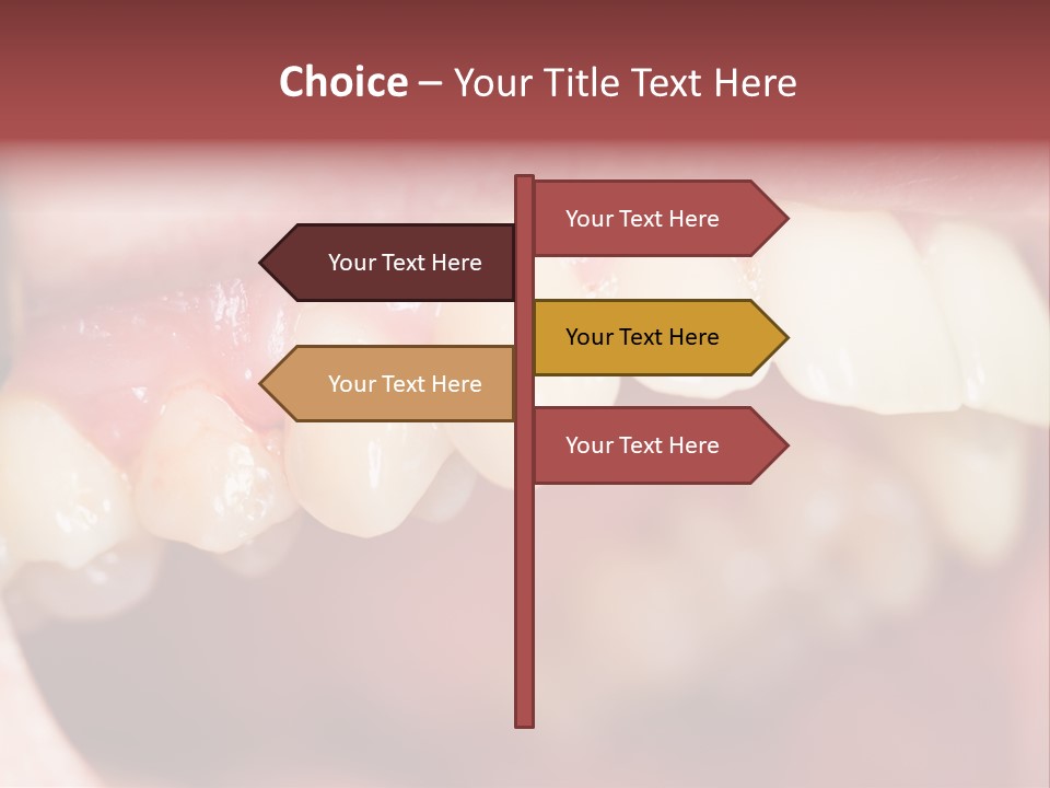 Mirror Exam Mouth PowerPoint Template