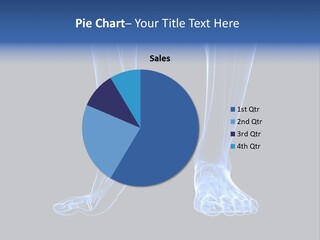 Joint Graphic Arthralgia PowerPoint Template