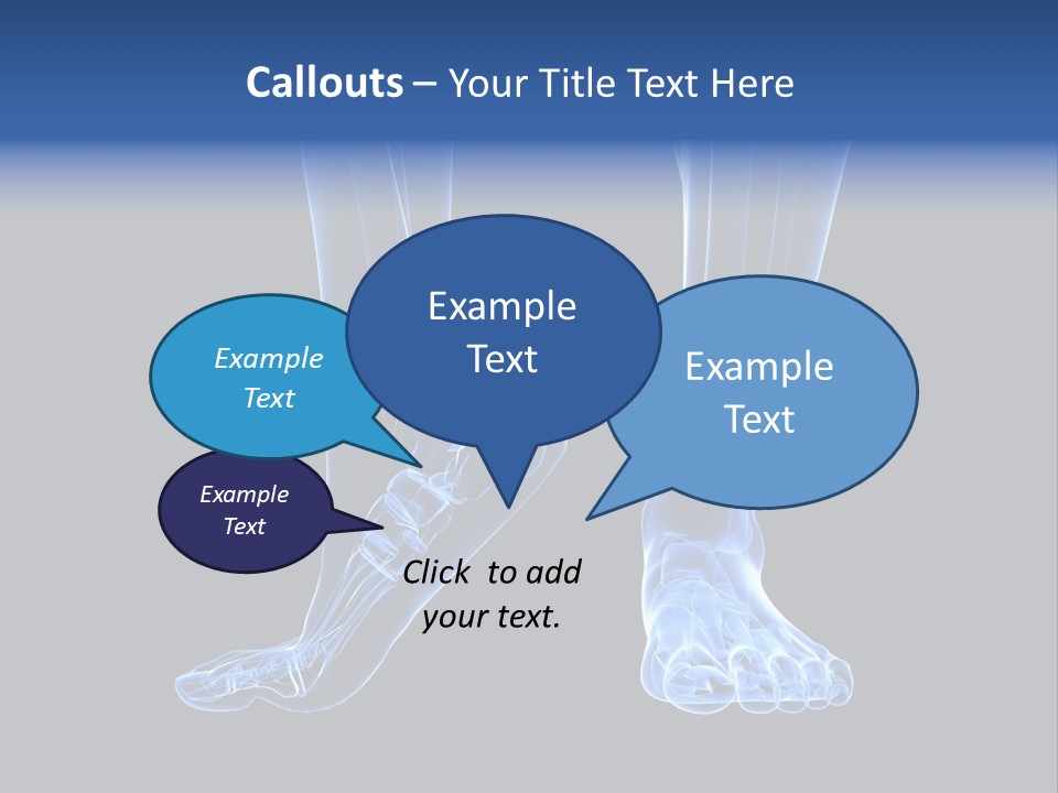 Joint Graphic Arthralgia PowerPoint Template