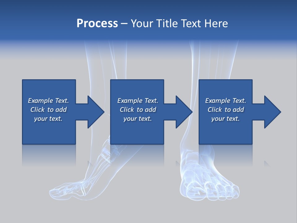 Joint Graphic Arthralgia PowerPoint Template