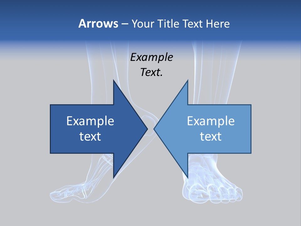 Joint Graphic Arthralgia PowerPoint Template