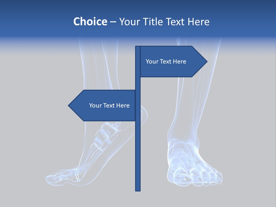 Joint Graphic Arthralgia PowerPoint Template