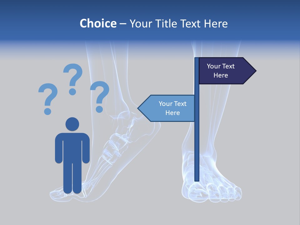 Joint Graphic Arthralgia PowerPoint Template