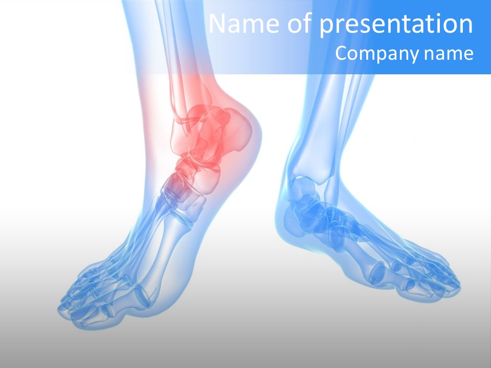 Foot Xray Ankle PowerPoint Template