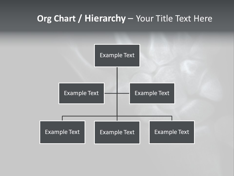 Healthcare Myocardial Infarction Biomedical PowerPoint Template