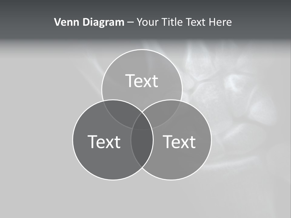 Healthcare Myocardial Infarction Biomedical PowerPoint Template