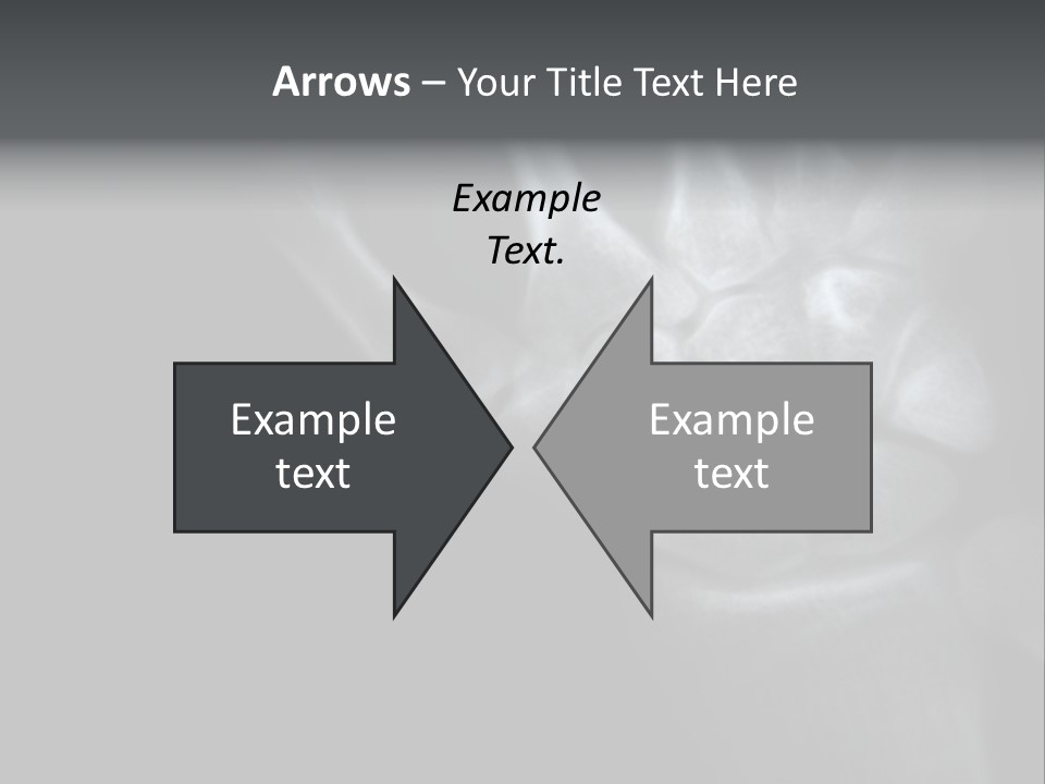 Healthcare Myocardial Infarction Biomedical PowerPoint Template