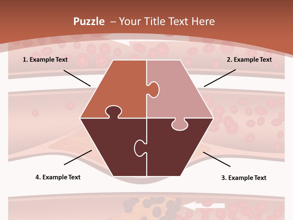 Cardiology Angina Myocardial Infarction PowerPoint Template