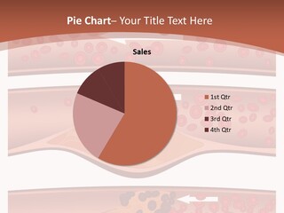 Cardiology Angina Myocardial Infarction PowerPoint Template