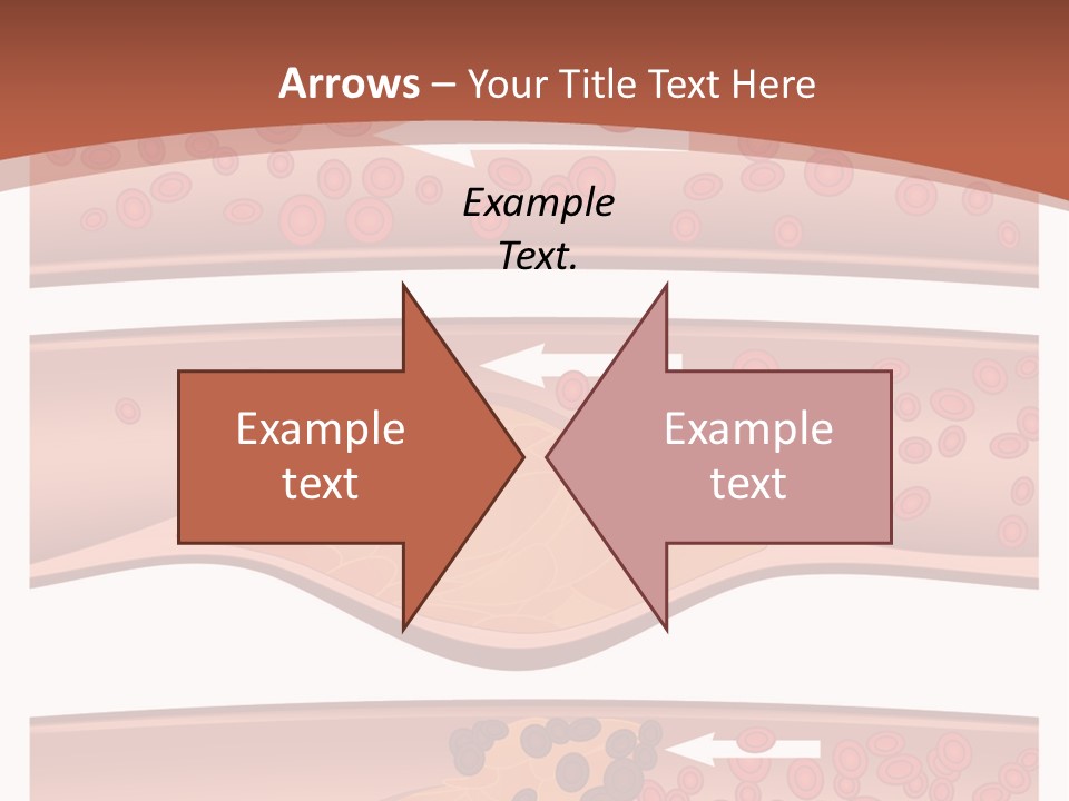 Cardiology Angina Myocardial Infarction PowerPoint Template