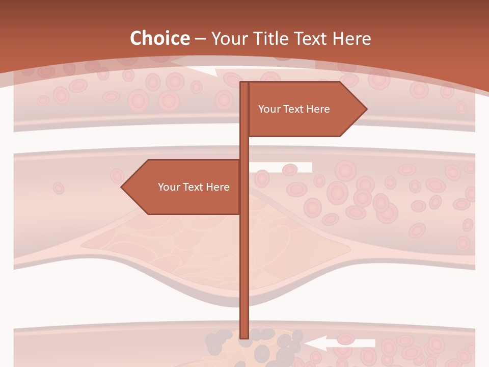 Cardiology Angina Myocardial Infarction PowerPoint Template