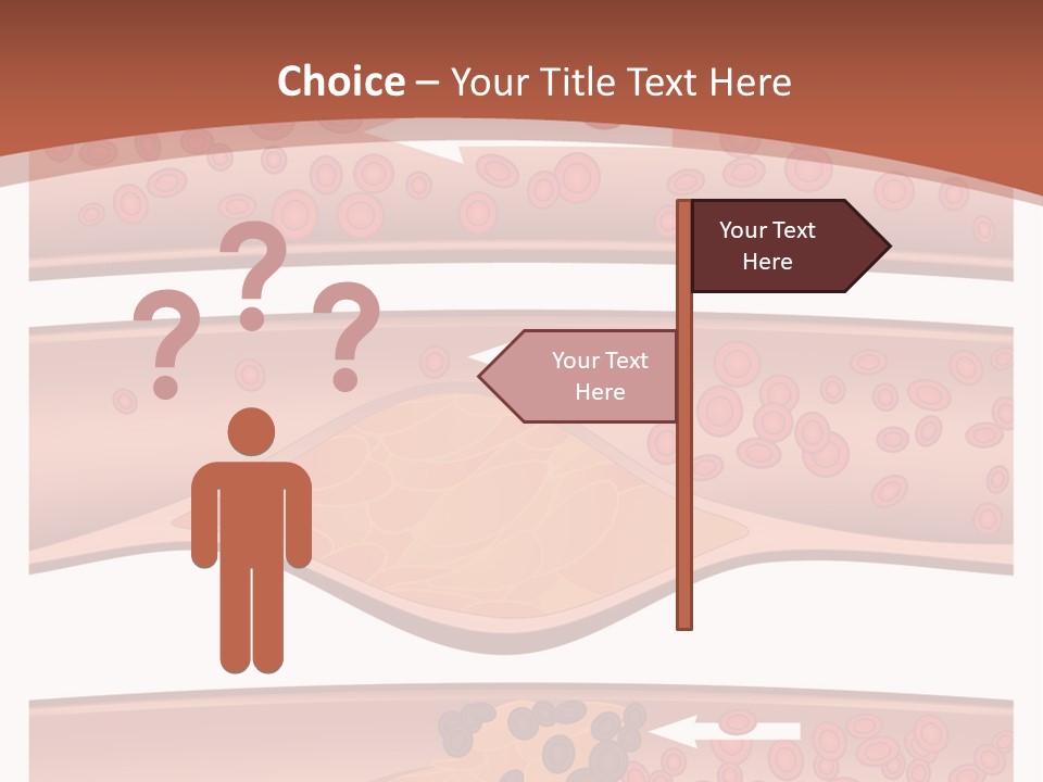 Cardiology Angina Myocardial Infarction PowerPoint Template