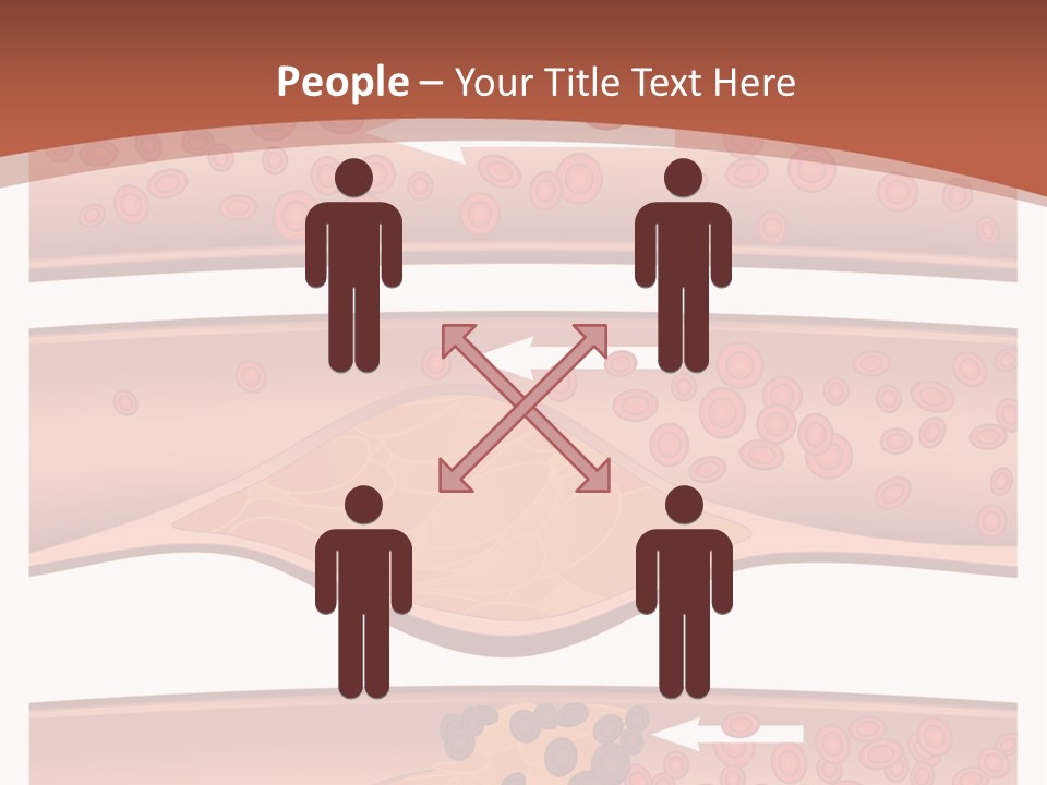 Cardiology Angina Myocardial Infarction PowerPoint Template