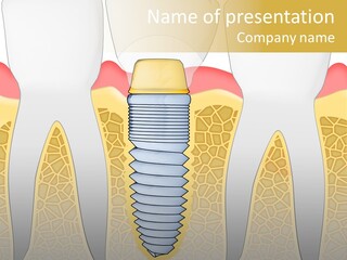 Care Clinic Implantation PowerPoint Template