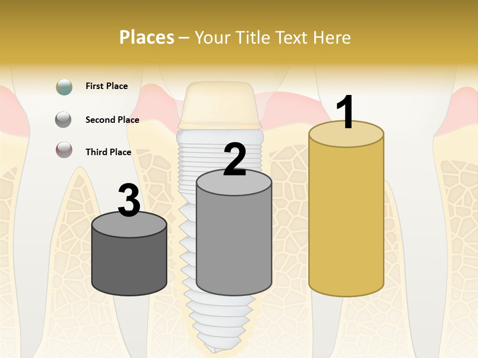 Care Clinic Implantation PowerPoint Template