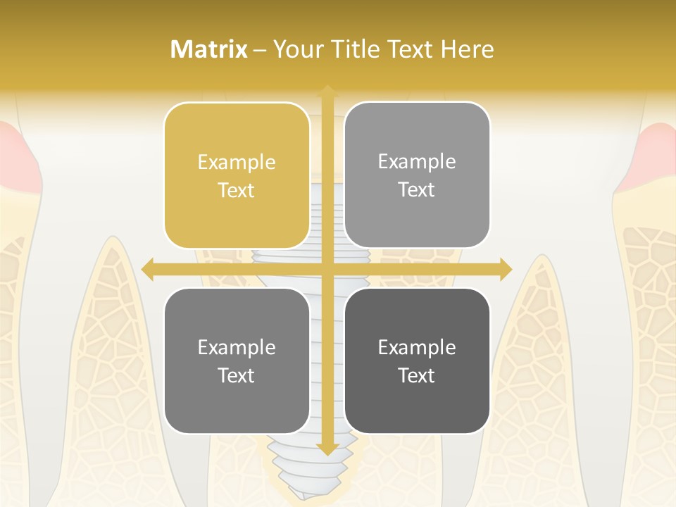 Care Clinic Implantation PowerPoint Template