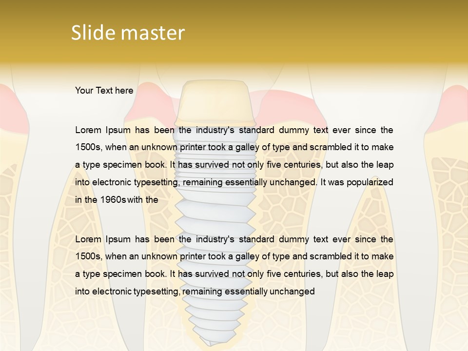 Care Clinic Implantation PowerPoint Template