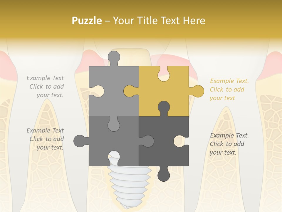 Care Clinic Implantation PowerPoint Template