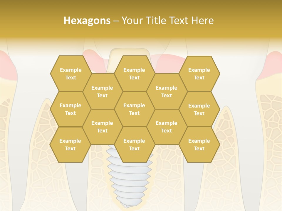 Care Clinic Implantation PowerPoint Template