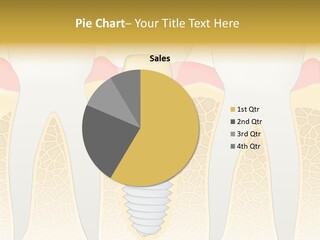 Care Clinic Implantation PowerPoint Template