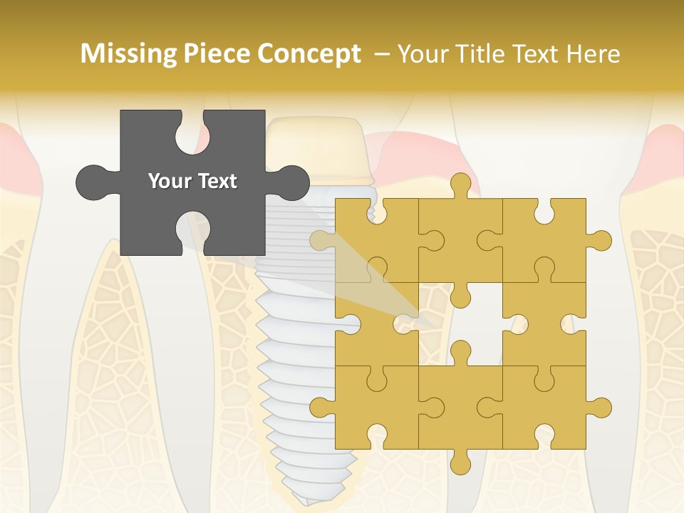 Care Clinic Implantation PowerPoint Template