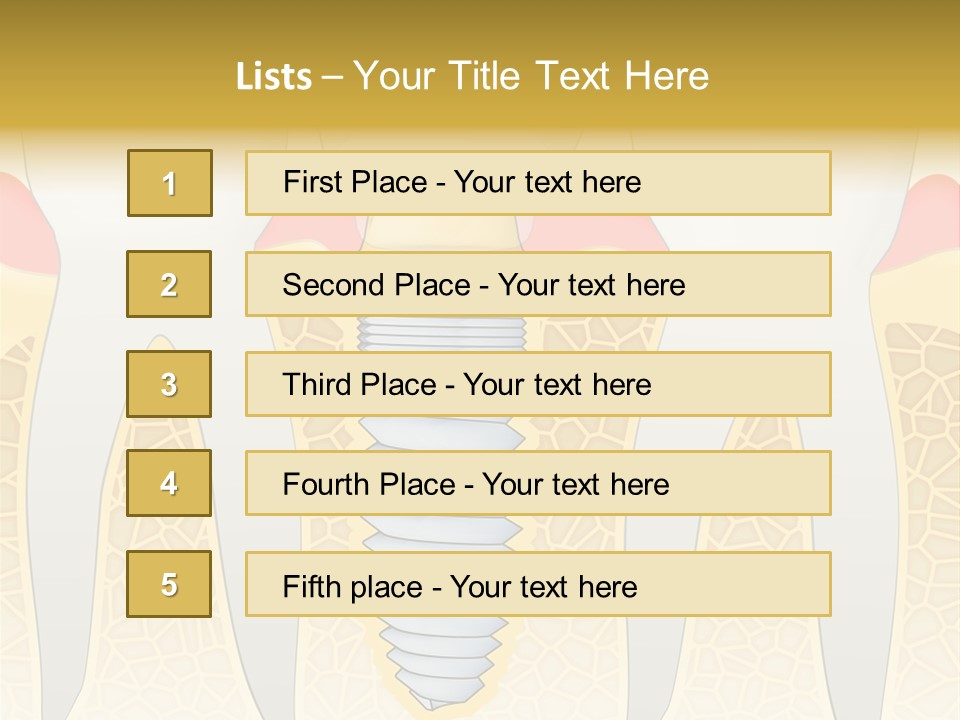Care Clinic Implantation PowerPoint Template