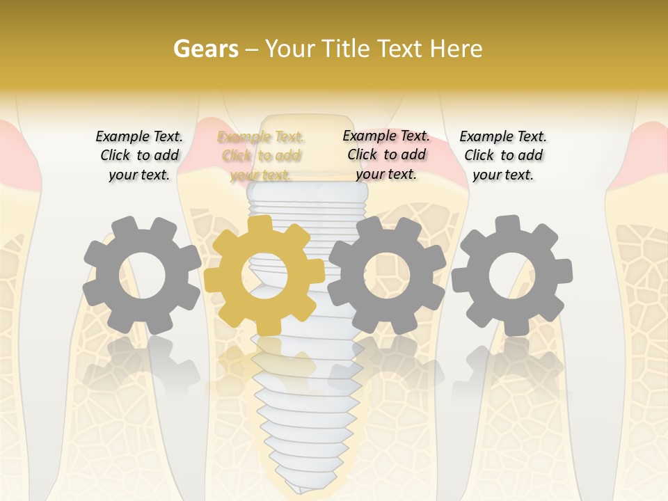 Care Clinic Implantation PowerPoint Template