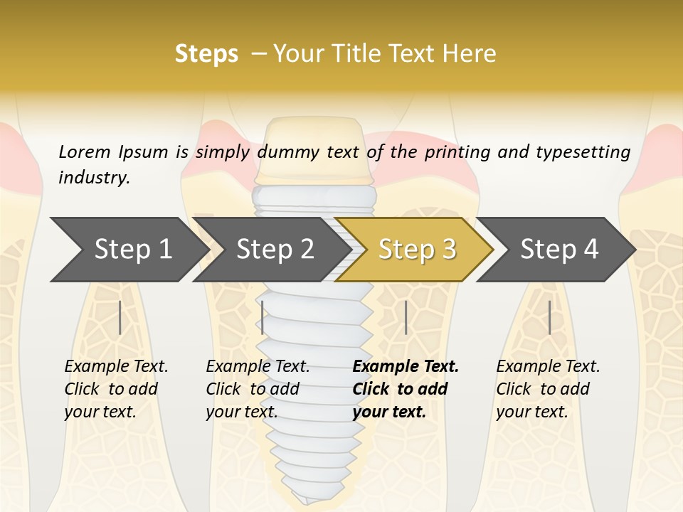 Care Clinic Implantation PowerPoint Template