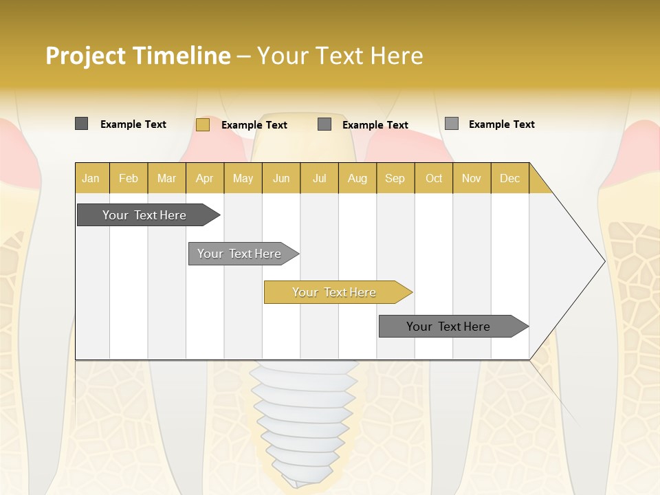 Care Clinic Implantation PowerPoint Template