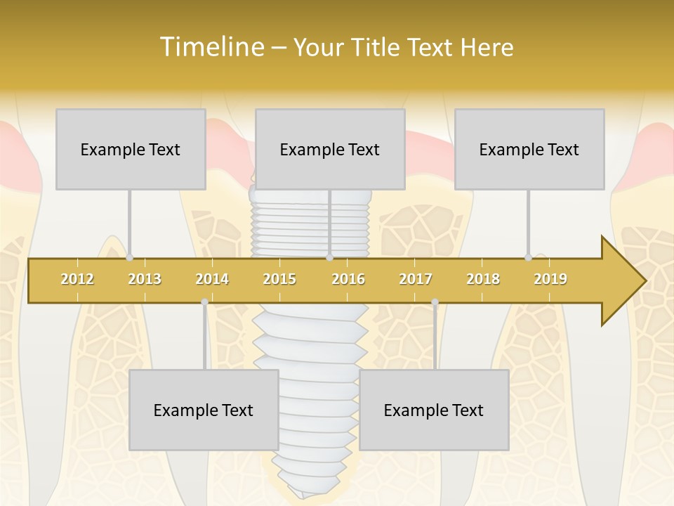 Care Clinic Implantation PowerPoint Template