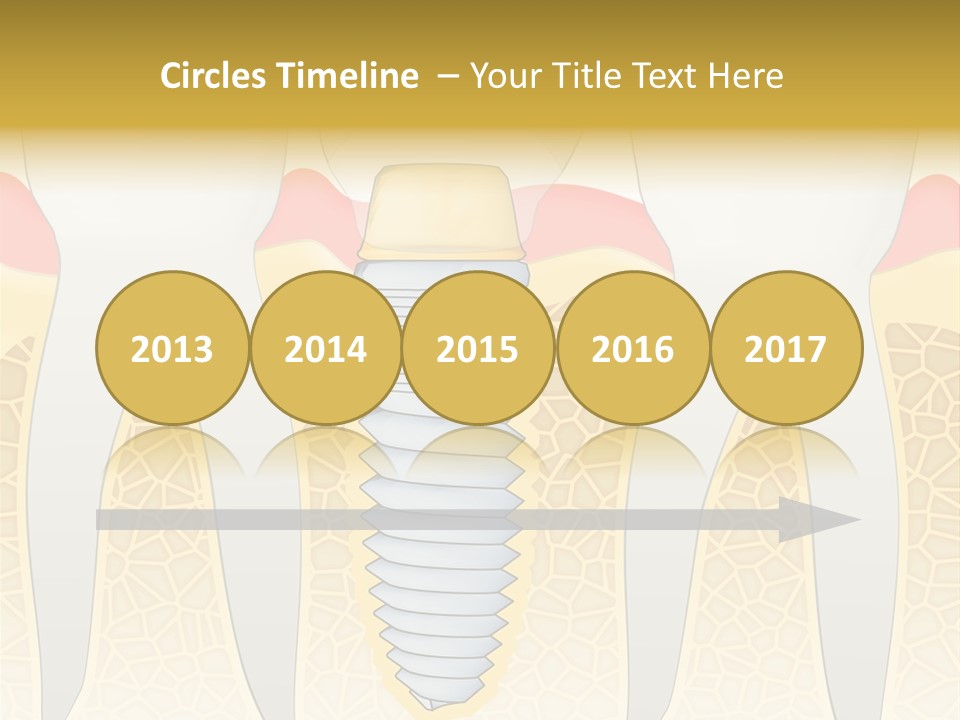 Care Clinic Implantation PowerPoint Template
