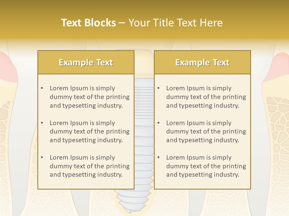 Care Clinic Implantation PowerPoint Template