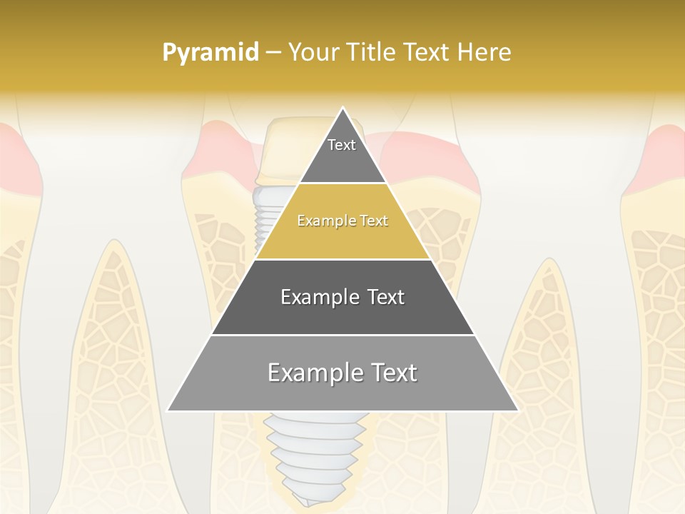 Care Clinic Implantation PowerPoint Template