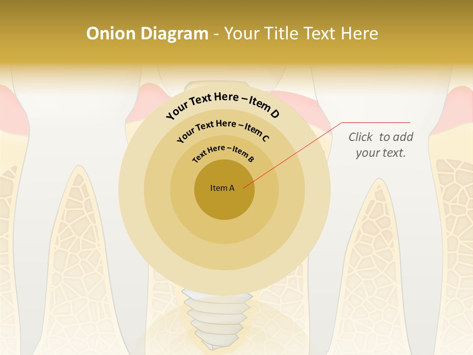 Care Clinic Implantation PowerPoint Template